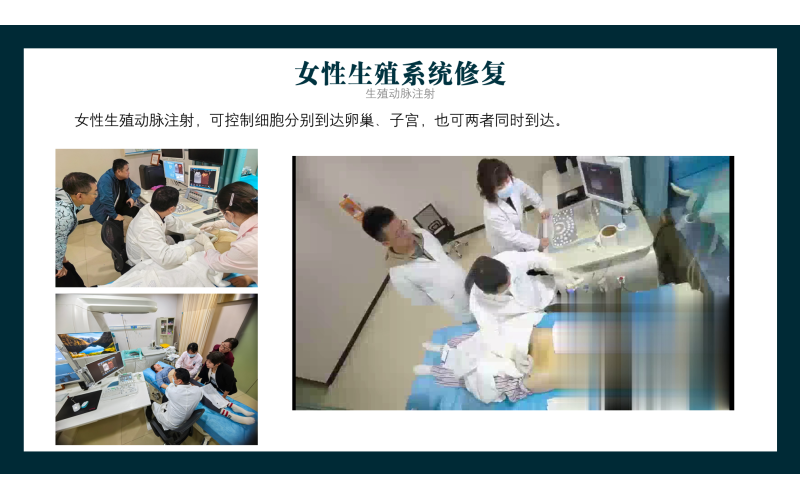 女性生殖系统修复
