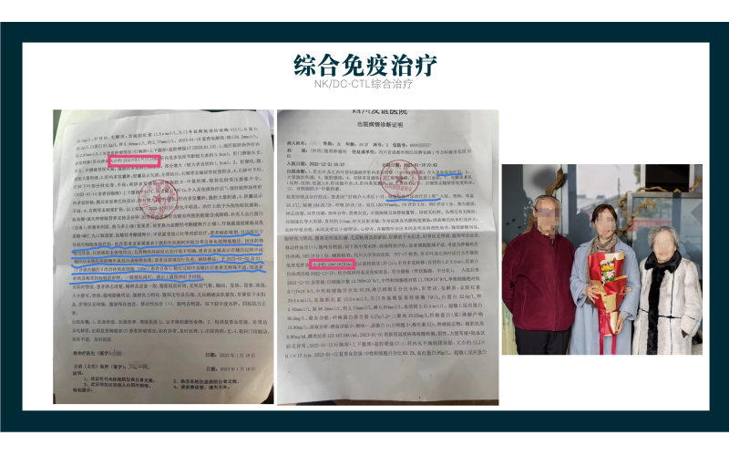综合免疫治疗治疗癌症